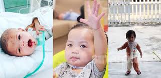 Ainul mardhiah dah sedar dan stabil. Video Pernah Menderita Kanser Mulut Adik Ainul Mardhiah Kini Sudah Laju Berjalan