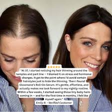 Glowmane Rapid Growth Roll On Formula