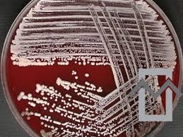 Image result for Staphylococcus Saprophyticus