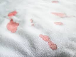 Wie bekommt man blut aus kleidung oder dem teppich raus? Blutflecken Entfernen Sofa Jeans Teppich Die Besten Hausmittel Heilpraxis