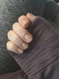 Growing Out My Nails After Biting Them My Whole Life This Is The Longest They Ve Ever Been Short Natural Nails Short Natural Nails Nails Nail Care