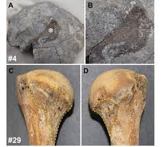 Image result for periostitis