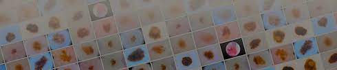 Understanding the symptoms and the risks associated with each type of skin cancer will help you determine the right course of treatment. Siim Isic Melanoma Classification Kaggle