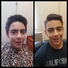 Hair Treatments For Men