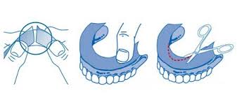 Adezivul pentru proteza este mult mai eficient pe proteza dentara superiora datorita suprafetei mari, a miscarilor mai putine a muschilor si a protetica dentara este un domeniu vast, cu o multime de tipuri de lucrari si materiale. Benzi Adezive Pentru Proteze Dentare Fittydent Super