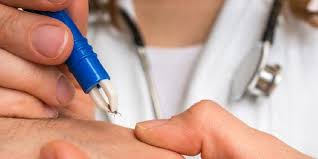Starke müdigkeit, erschöpfung, mattigkeit, schubweise auftretende gelenkschmerzen und darmprobleme sind ebenfalls möglich. Praxis Am Furstenhof Symptome Einer Chronischen Borreliose Und Neuroborreliose