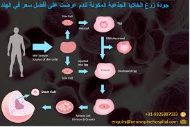 لا بد أن يسند الإِشراف على عمليات زراعة الأعضاء إلى هيئة. Ø§Ù„Ø¹Ù…ÙˆØ¯ Ø§Ù„ÙÙ‚Ø±ÙŠ ÙˆØ¬Ø±Ø§Ø­Ø© Ø§Ù„Ø£Ø¹ØµØ§Ø¨ Ø¨Ù…Ø³ØªØ´ÙÙ‰ Ø§Ù„Ù‡Ù†Ø¯ Ø¬ÙˆØ¯Ø© Ø²Ø±Ø¹ Ø§Ù„Ø®Ù„Ø§ÙŠØ§ Ø§Ù„Ø¬Ø°Ø¹ÙŠØ© Ø§Ù„Ù…ÙƒÙˆÙ†Ø© Ù„Ù„Ø¯Ù… Ø¹Ø±Ø¶Øª Ø¹Ù„Ù‰ Ø£ÙØ¶Ù„ Ø³Ø¹Ø± ÙÙŠ Ø§Ù„Ù‡Ù†Ø¯