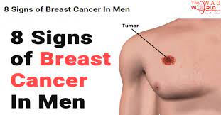 But men tend to delay going to the doctor until they have more severe symptoms, like bleeding from the nipple. 8 Signs Of Breast Cancer In Men