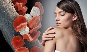Blood tests can also give your doctor an idea of how well. Blood Cancer Symptoms Petechiae In The Skin Could Be A Sign To Look Out For Express Co Uk