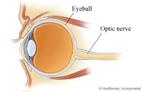 Image result for Optic Neuritis