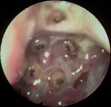 More about dust and skin mites and itchy skin in general. Https Ispub Com Ijhns 4 1 9491