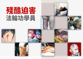 Maybe you would like to learn more about one of these? 4 ä¸­å…±æ®˜é…·è¿«å®³æ³•è¼ªåŠŸ æ³•è¼ªåŠŸçœŸç›¸ é¦™æ¸¯