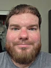 Eso sí que es un fondo. Vistas distantes de Ocean City y Atlantic City  desde el Parque Estatal Inlet de Corson.