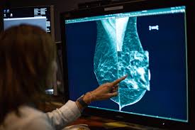 May be used in breast cancer staging to define the extent of the primary tumour or to detect multifocal/multicentric disease in the ipsilateral breast. New Breast Cancer Screening Laws Technology Give Advocates Hope In Closing Gaps In Care Connecticut Public Radio