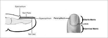 Image result for paronychium