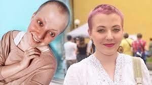 Líbila se vám anna slováčková? Anna Slovackova Ma Za Sebou Rok Lecby Rakovinu Bych Nejradsi Vymazala Ze Zivota Extra Cz