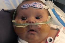 Fundraiser for Jasmine Thompson by Casey Mason : Love for Olivia