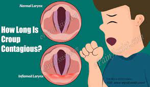 How Long Is Croup Contagious How Do You Treat Croup At Home