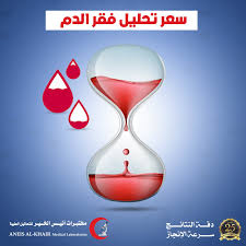 البرج ما هو سعر تحليل Cbc