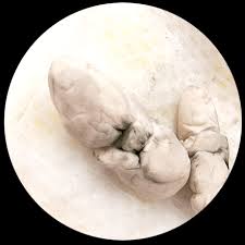 Apart from clay color colored stool other symptoms are suggestive of some viral infection,with vomiting,altered bowel pattern,fever with sores. Check Your Baby S Poop With The Similac Stool Tool
