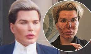 Maybe you would like to learn more about one of these? Human Ken Doll Rodrigo Alves Shows Off His New Look New Hair Look Makeup Looks White Hair Highlights