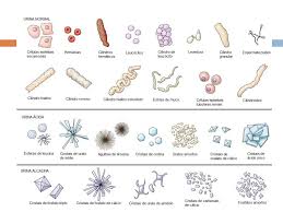 Grátis: urinálise 200913 - Material Claro e Objetivo em PDF para Estudo  Rápido