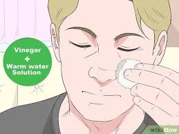 Start the treatment by applying ice on the injured part of the face. How To Treat Bruises On Your Face 12 Steps With Pictures