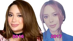 Arci muñoz shares what happened to her nose when she sang in a gig. Pinoy Top List Is Arci Munoz Addicted To Plastic Surgery