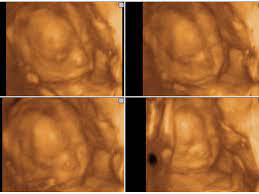 دوبلر ملون على الثدى ناحتين. Ù…Ø±ÙƒØ² Ø­ÙƒÙŠÙ… Ø£ÙˆØºÙ„Ùˆ Ø¯ÙˆØ¨Ù„Ø± Ù…Ù„ÙˆÙ† Ù„Ù„Ø¬Ù†ÙŠÙ† ÙÙŠ Ø¨Ø¯Ø§ÙŠØ© Ø§Ø³Ø§Ø¨ÙŠØ¹ Ø§Ù„Ø­Ù…Ù„ Facebook