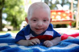 Born with rare brain cancer, Huntley boy beats odds to begin kindergarten