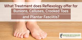 reflexology treatments for bunions calluses crooked toes