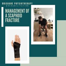 Image result for Scaphoid Fracture Signs
