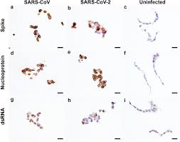 Explore literature, identify clinical trials, and compounds used in them. Development Of Immunohistochemistry And In Situ Hybridisation For The Detection Of Sars Cov And Sars Cov 2 In Formalin Fixed Paraffin Embedded Specimens Scientific Reports