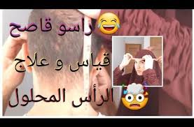 طريقة قياس الرأس المحلول و أسبابه و علاج آلام و برودة الرأس و الشقيقة بطريقة سهلة جدا Youtube