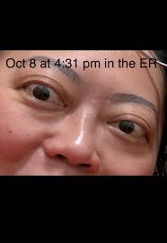 I love seeing how far I've come 💛 My thyroid hormones—including TSH—have  been in a great range since early 2024, but getting my eyes to calm down  naturally (without surgery!) took a