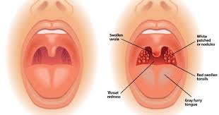 Pin On Health