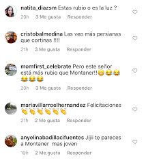 «el extraño de pelo largo.» Fernando Solabarrieta Llama La Atencion Con Nuevo Look Al Natural