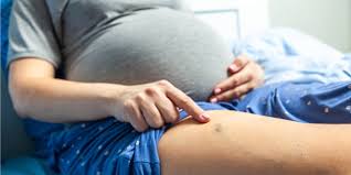 Blood clots are a serious medical condition that can have fatal side effects if left untreated, and if one develops during your pregnancy it could put both you and your baby at risk. Deep Vein Thrombosis In Pregnancy Symptoms Risks And Treatment Pristyn Care