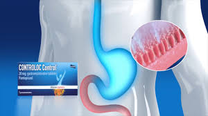 Controloc 40mg is a proton pump inhibitor that decreases the amount of acid produced in the stomach. Controloc 40 Mg Pret Controloc 40 Mg