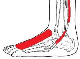 Pin On Foot Pain Symptoms