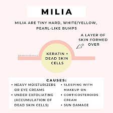 Often Mistaken For Whiteheads Milia Are Hard White Yellow Pearl Like Bumps Filled With Dead Skin Cells And Kera Dead Skin Cells Skin Cells Skin Care Secrets