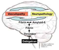 Ramona merki, heike schwarb, dimitrios a tsakiris. Ijms Free Full Text Alzheimer S Disease Rationales For Potential Treatment With The Thrombin Inhibitor Dabigatran Html