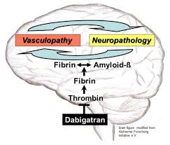 Scottish dental clinical effectiveness programme. Ijms Free Full Text Alzheimer S Disease Rationales For Potential Treatment With The Thrombin Inhibitor Dabigatran Html