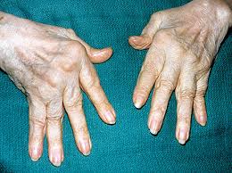 Image result for Hand Exam
