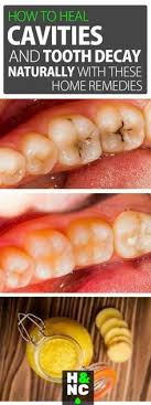 How is neem used to treat dental cavities? 12 Best Home Remedies For Cavities Ideas Remedies Health Remedies Home Remedies