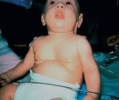 Pediatric Advanced Life Support Study Guide