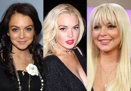 Lindsay Lohan And The Rise Of The 20-Something Cosmetic Surgery Patient