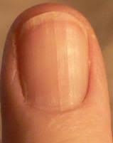 Biting The Inside Of Your Cheek By Accident Fingernails Fingernail Health Nail Health Health And Beauty Tips