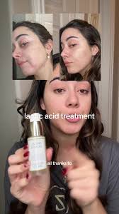 Sunday Riley Good Genes Lactic Acid Treatment Review