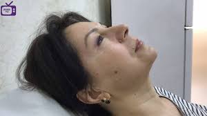 Op.Dr.Burak Ersen (Estetik Plastik Cerrahi Uzmanı)